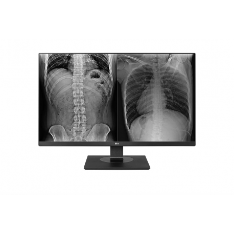 LG 27HJ713C 27" CLINICAL UHD IPS DVI/DP/HDMI - 0