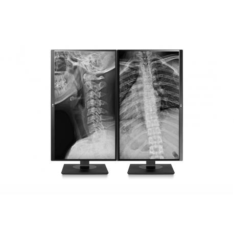 LG 27HJ713C 27" CLINICAL UHD IPS DVI/DP/HDMI - 1