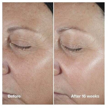 Tray Porous Pad Assy Ciss Eppi - 2