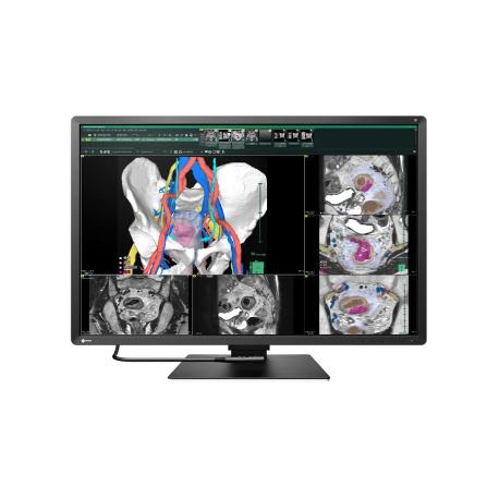 EIZO RadiForce RX270 - LCD monitor - 2MP - colour - 21.3" - 1200 x 1600 - IPS - 1000 cd / m² - 1800:1 - 20 ms - DVI-D, 2xDisplayPort - black - 0