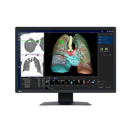 EIZO RadiForce MX243W-BK - LED monitor - 24" (24.1" viewable) - 1920 x 1200 @ 61 Hz - IPS - 410 cd / m² - 1350:1 - 22 ms - DVI-D, DisplayPort - black - 0