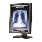 Medical displays